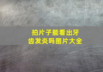 拍片子能看出牙齿发炎吗图片大全