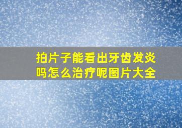 拍片子能看出牙齿发炎吗怎么治疗呢图片大全