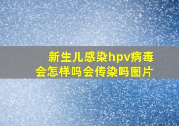 新生儿感染hpv病毒会怎样吗会传染吗图片