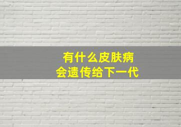 有什么皮肤病会遗传给下一代