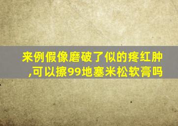 来例假像磨破了似的疼红肿,可以擦99地塞米松软膏吗