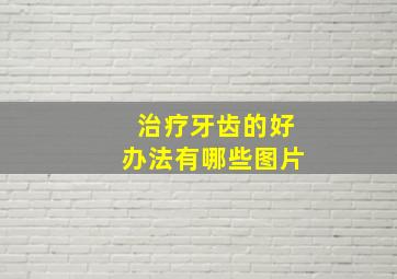 治疗牙齿的好办法有哪些图片