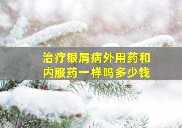 治疗银屑病外用药和内服药一样吗多少钱