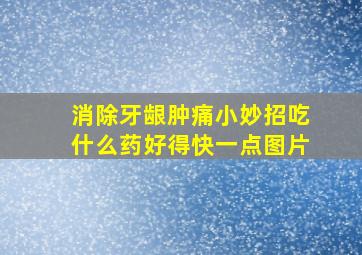 消除牙龈肿痛小妙招吃什么药好得快一点图片