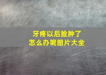 牙疼以后脸肿了怎么办呢图片大全