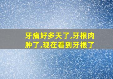 牙痛好多天了,牙根肉肿了,现在看到牙根了