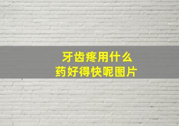 牙齿疼用什么药好得快呢图片