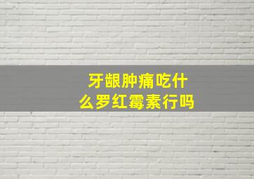 牙龈肿痛吃什么罗红霉素行吗