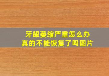 牙龈萎缩严重怎么办真的不能恢复了吗图片