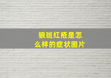 狼斑红疮是怎么样的症状图片