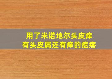 用了米诺地尔头皮痒有头皮屑还有痒的疙瘩