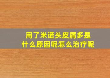 用了米诺头皮屑多是什么原因呢怎么治疗呢