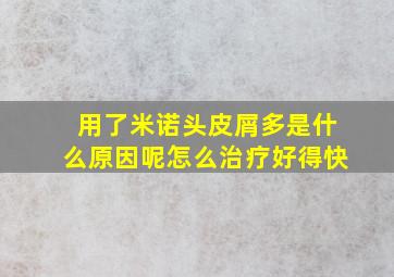 用了米诺头皮屑多是什么原因呢怎么治疗好得快