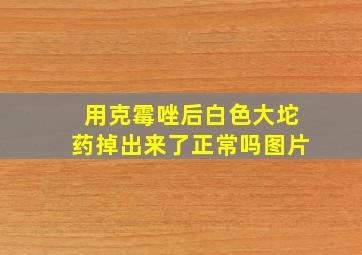 用克霉唑后白色大坨药掉出来了正常吗图片