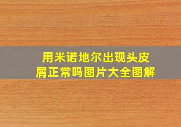 用米诺地尔出现头皮屑正常吗图片大全图解