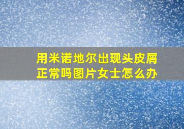 用米诺地尔出现头皮屑正常吗图片女士怎么办