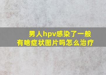 男人hpv感染了一般有啥症状图片吗怎么治疗