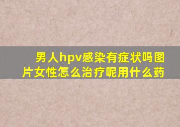 男人hpv感染有症状吗图片女性怎么治疗呢用什么药