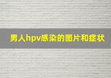 男人hpv感染的图片和症状