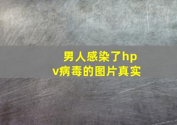 男人感染了hpv病毒的图片真实