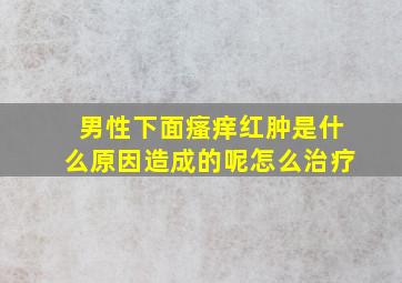 男性下面瘙痒红肿是什么原因造成的呢怎么治疗