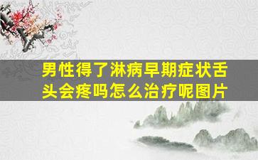 男性得了淋病早期症状舌头会疼吗怎么治疗呢图片