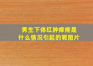 男生下体红肿痒疼是什么情况引起的呢图片