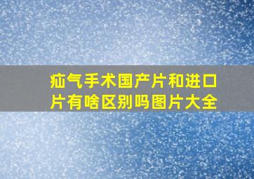 疝气手术国产片和进口片有啥区别吗图片大全