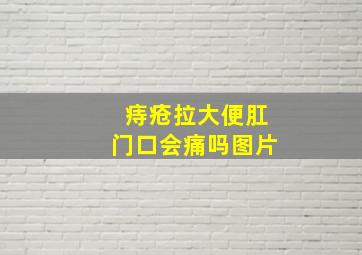 痔疮拉大便肛门口会痛吗图片