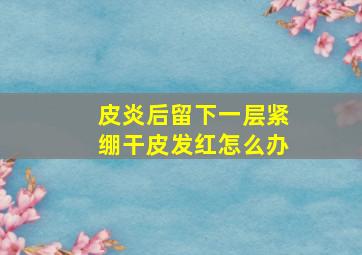 皮炎后留下一层紧绷干皮发红怎么办