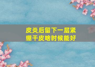 皮炎后留下一层紧绷干皮啥时候能好