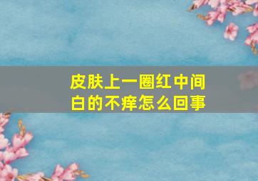 皮肤上一圈红中间白的不痒怎么回事