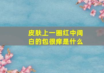 皮肤上一圈红中间白的包很痒是什么