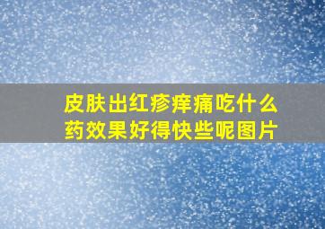 皮肤出红疹痒痛吃什么药效果好得快些呢图片