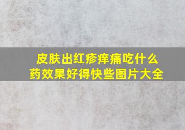 皮肤出红疹痒痛吃什么药效果好得快些图片大全