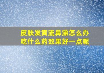 皮肤发黄流鼻涕怎么办吃什么药效果好一点呢