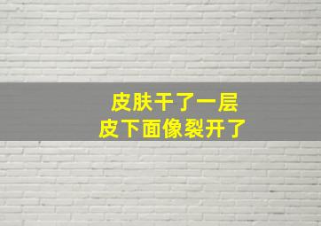 皮肤干了一层皮下面像裂开了