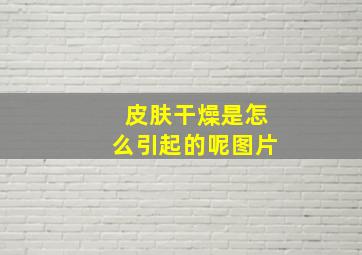 皮肤干燥是怎么引起的呢图片