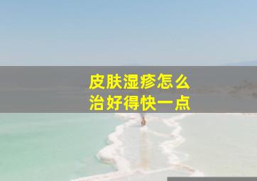 皮肤湿疹怎么治好得快一点