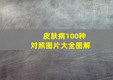 皮肤病100种对照图片大全图解