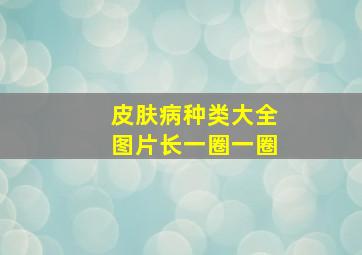 皮肤病种类大全图片长一圈一圈