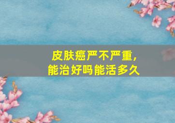 皮肤癌严不严重,能治好吗能活多久