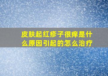 皮肤起红疹子很痒是什么原因引起的怎么治疗