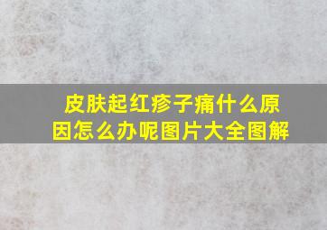 皮肤起红疹子痛什么原因怎么办呢图片大全图解