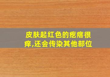 皮肤起红色的疙瘩很痒,还会传染其他部位