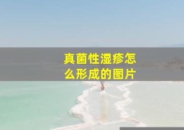 真菌性湿疹怎么形成的图片