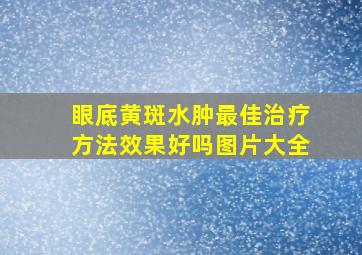 眼底黄斑水肿最佳治疗方法效果好吗图片大全