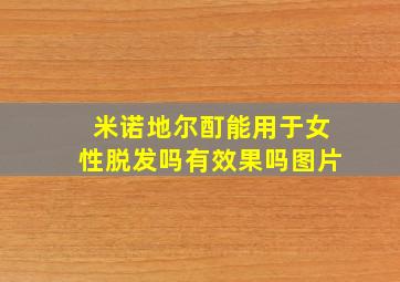 米诺地尔酊能用于女性脱发吗有效果吗图片