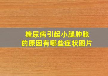 糖尿病引起小腿肿胀的原因有哪些症状图片