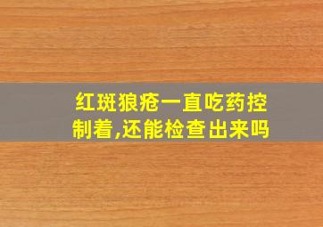 红斑狼疮一直吃药控制着,还能检查出来吗